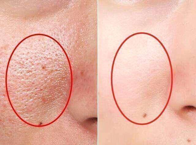 胶原蛋白是干嘛的有什么好处,胶原蛋白属于什么属性