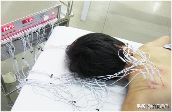 肩不举,肩周炎严重手抬不起最佳治疗办法