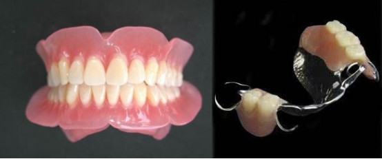 假牙引发口炎很烦恼？教您轻松解决！