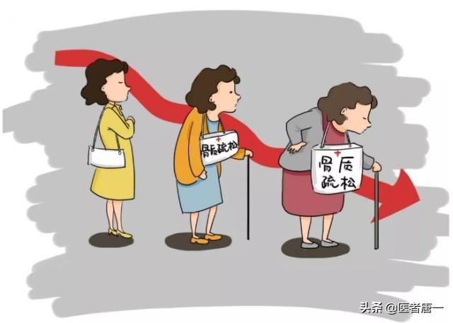 50岁严重的骨质疏松怎么办,女性50岁补钙什么牌子最好