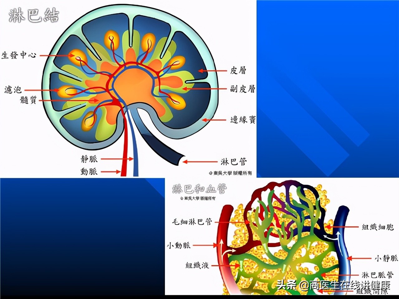 浸润癌是最严重的癌吗,浸润癌恶性