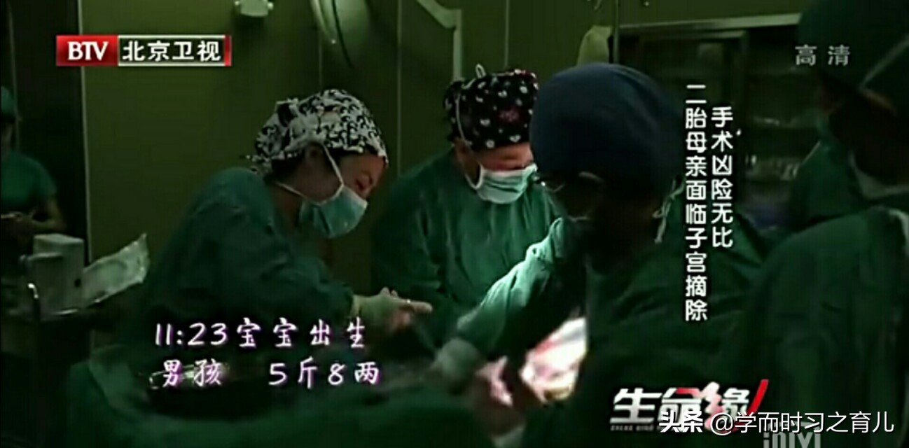 怀孕爸爸需要知道的事,怀孕初期能看出前置胎盘吗