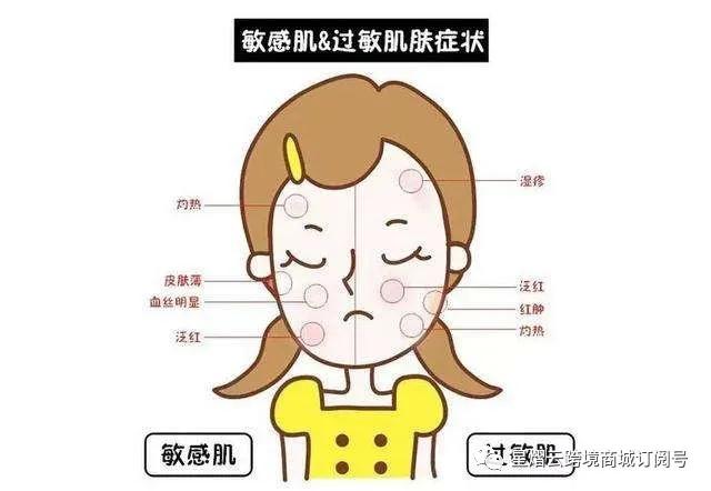 皮肤干燥怎么办女生,皮肤干燥怎么办用什么护肤品