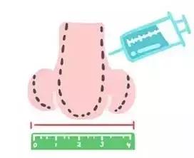 隆鼻能坚持到老吗,隆鼻的潜规则有哪些