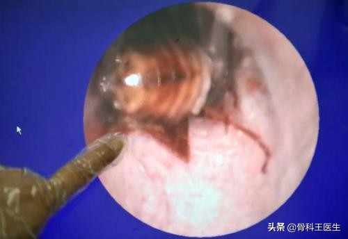 为什么会有人塞异物到直肠里,为什么会有人往尿道里塞异物