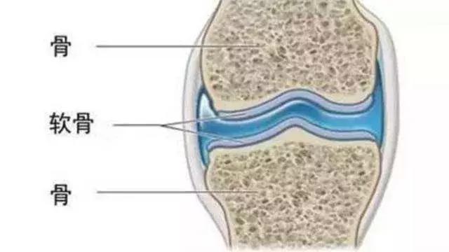 膝盖疼痛千万别忍着！骨科大夫教你搞定膝关节炎