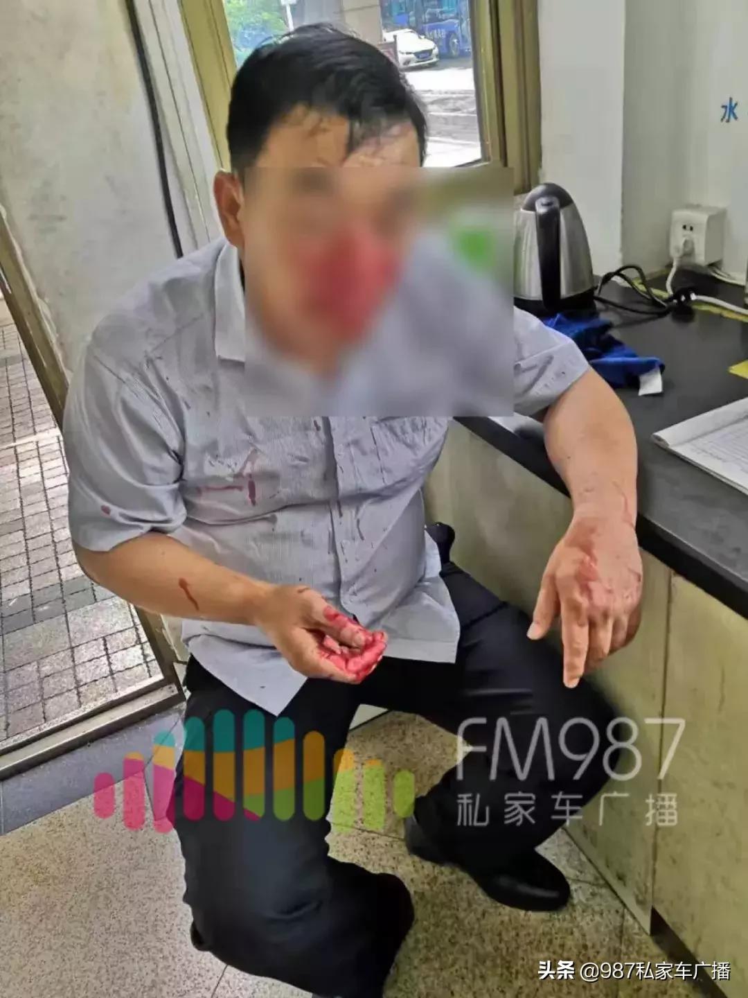 福州一小区保安打死业主,福州小区保安打业主