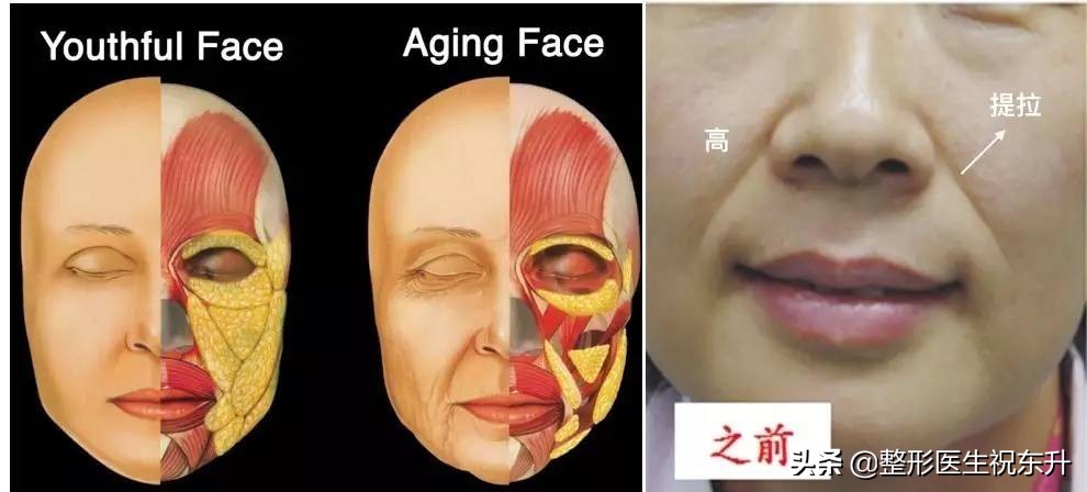 也许从一开始就错了图片,突然有了很深的法令纹