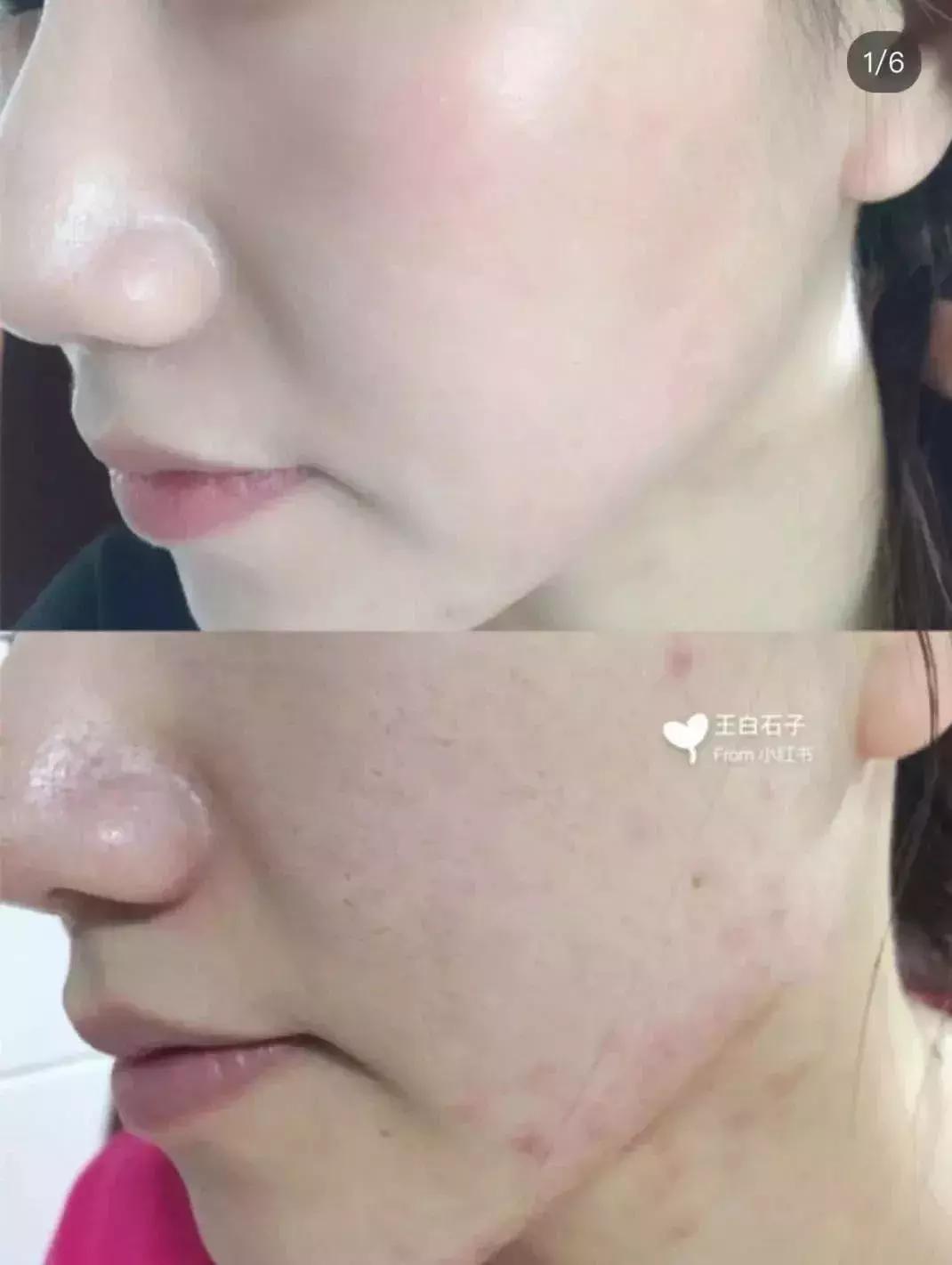 巨好用粉底液油皮夏天能用吗,十大干油皮遮瑕持久最好用粉底液