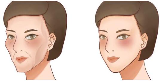 天生面部凹陷怎么快速消除,解决面部凹陷是什么原理
