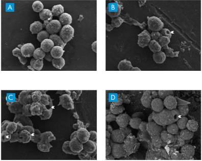 癌症疫苗将问世是真的吗,癌症疫苗或将问世
