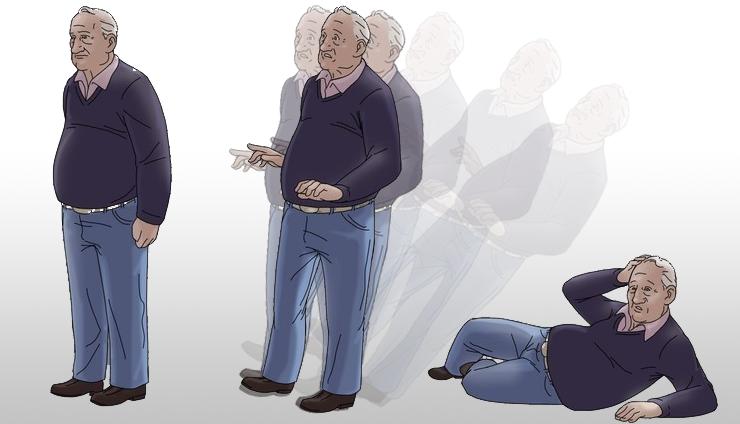 老人前庭神经眩晕症,田志亮谈头晕眩晕慢性前庭综合征