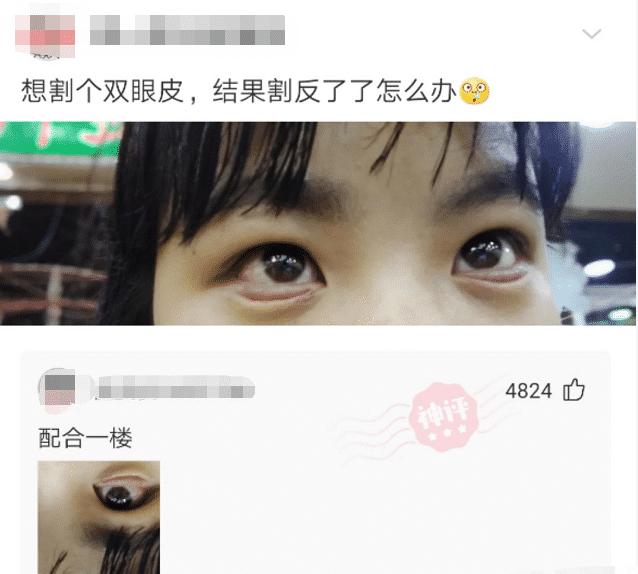 割双眼皮割反了,想割双眼皮又怕不好看