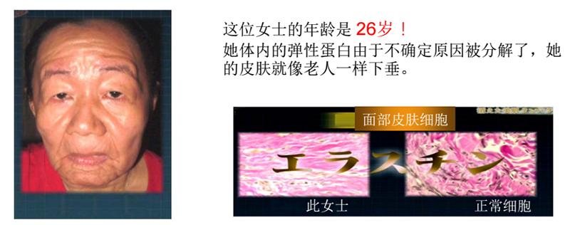 弹性蛋白哪里的最好,关于胶原蛋白肽的知识