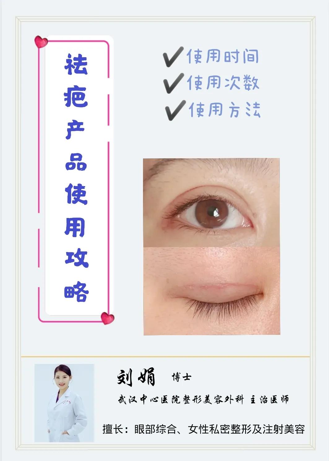 外伤疤痕用什么祛疤产品效果好,凹陷性疤痕用什么祛疤产品