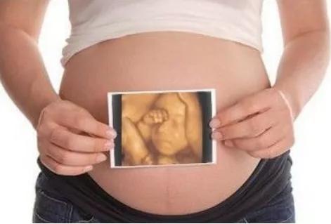 四维老是检查不到心脏,四维彩超通不过是怎么回事