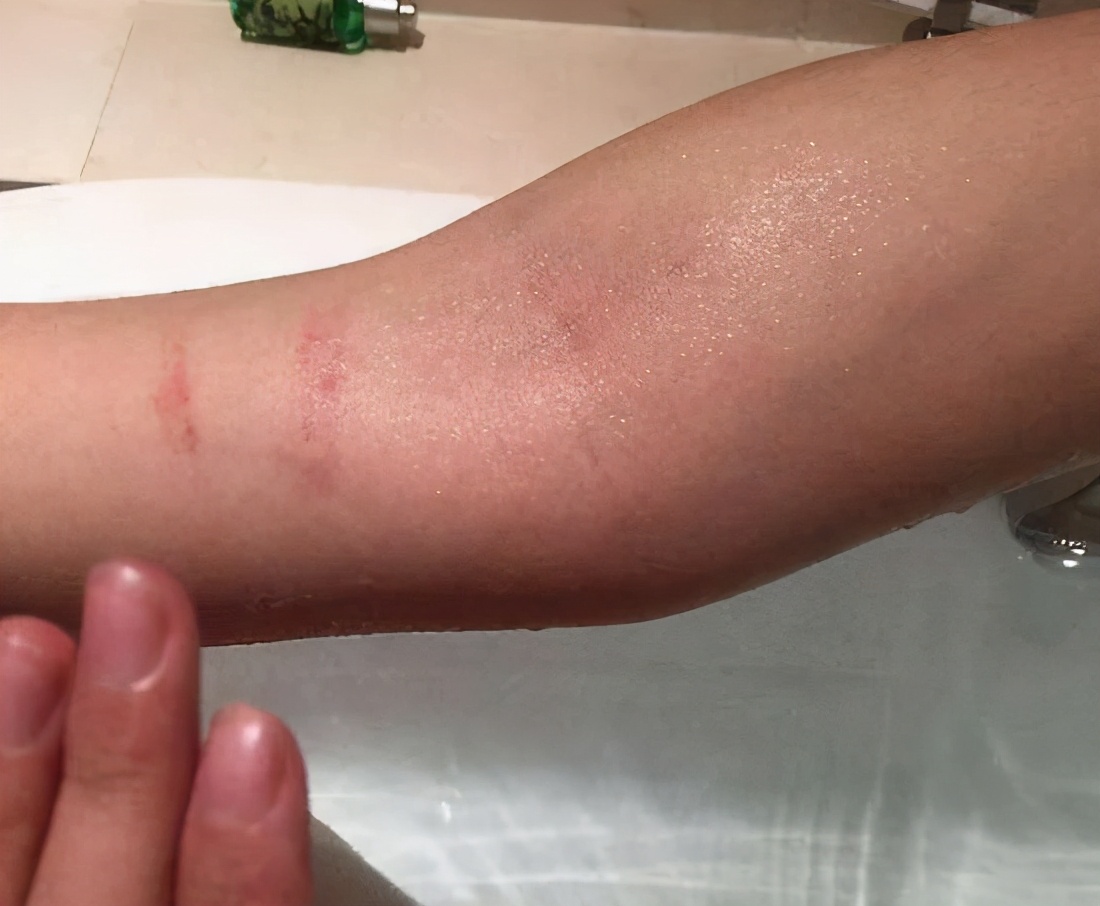 女子遭黑车司机强奸并刺伤,女子遭黑车司机侵害