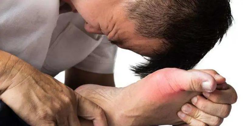 关节一热就刺痛,关节突然发热疼痛