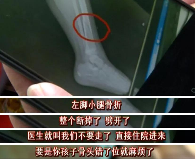 高位截瘫小孩10岁康复训练,小孩高位截瘫功能锻炼