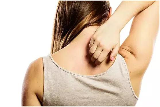 湿疹性皮炎最简单的自愈方法,全身都痒皮炎湿疹最好的治疗方法