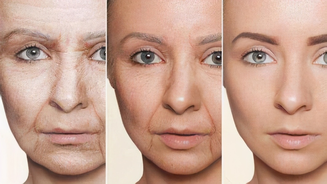 法令纹显老是什么原因,你比同龄人看起来老的原因是什么