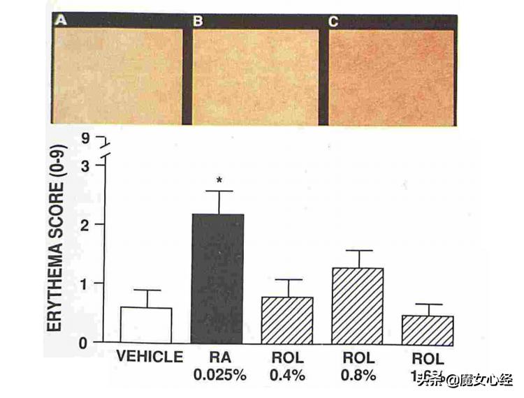 这样使用A醇产品，既能抗皱淡纹，又不伤害皮肤