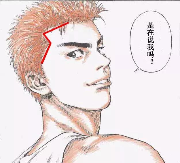 拯救发际线高额头大的发型,发际线大额头宽适合什么发型