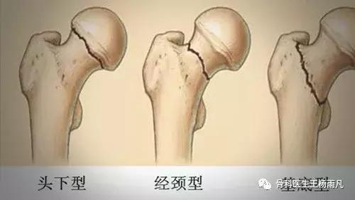 鬼门关前一道坎全集,鬼门关前的一道坎