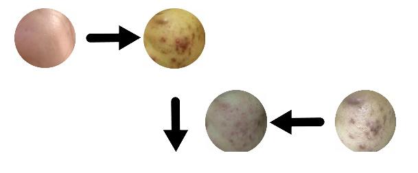 6岁女孩皮肤越来越黑黄是咋回事,皮肤天生黑黄是个什么原因