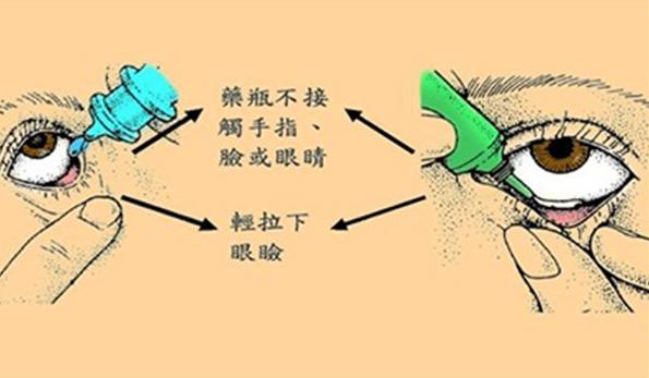 眼药的副作用及危害,眼药副作用