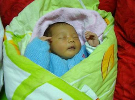 家长土方治黄疸，宝宝全身烫伤悔不当初！2种黄疸类型要分清楚！