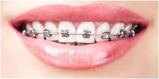 从3分到10分中间需要几分钟,从3分到4分付出了多大努力