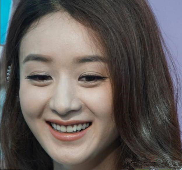 李小璐双眼皮褶,被美颜坑惨的明星