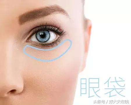 眼袋泪沟怎么去除男生,怎么去除眼袋和泪沟黑眼圈