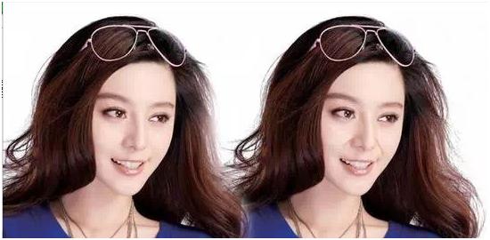 法令纹显老做什么美容最好,法令纹怎么消除最显老