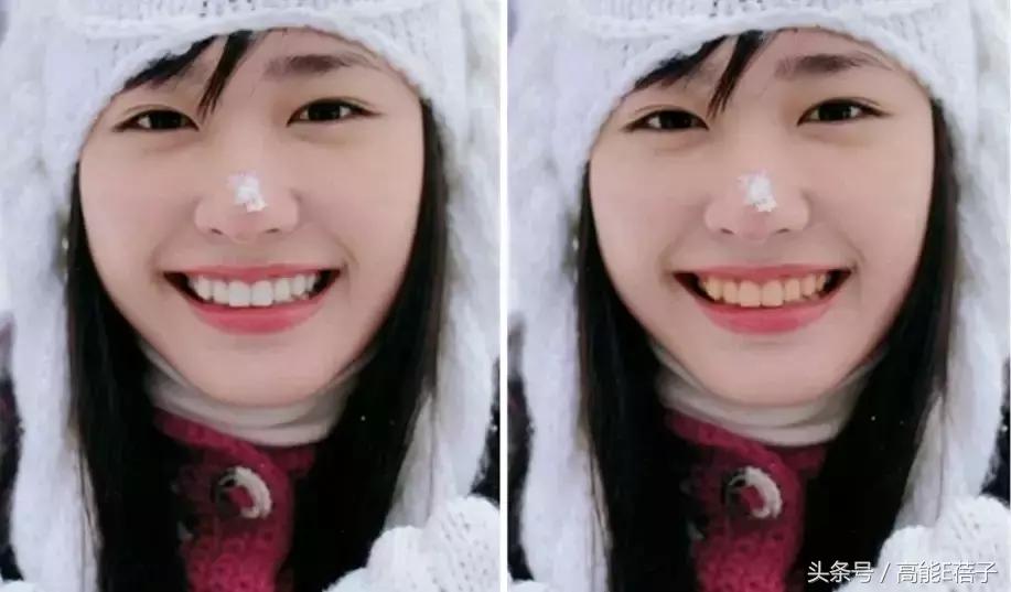 高圆圆牙齿美白,高圆圆40岁美白秘诀