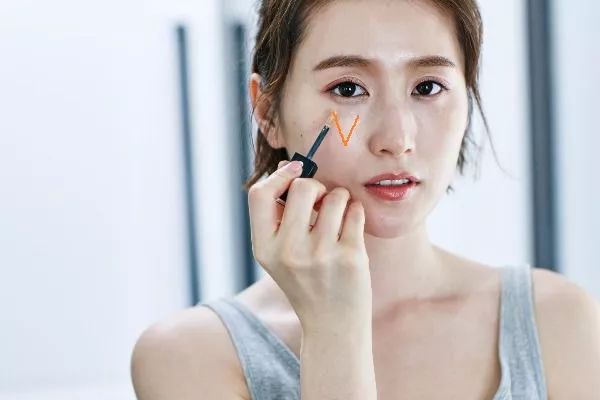 泪沟深的让人心疼？四步填补泪沟“黑科技”