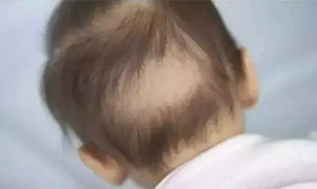 新生儿常见生理现象及护理,新生儿正常生理现象