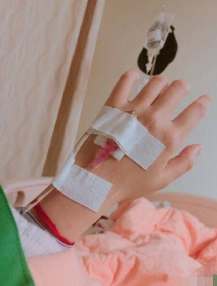 安以轩手术后报平安,被传宫外孕?经纪人:她现在不便打扰