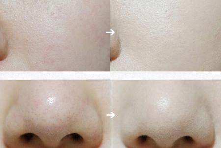 油皮bb霜好用排行榜推荐女,蒂佳婷银管bb霜黄黑皮测评