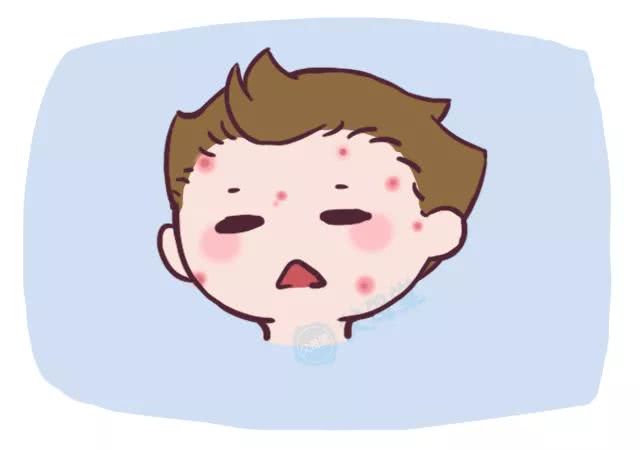 过敏原ige检测查哪些项目,孩子查过敏原有必要么