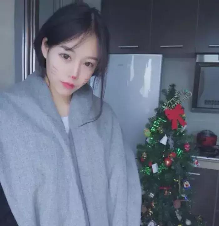 免费分享一个拯救发际线的方法,权威专家教你拯救发际线