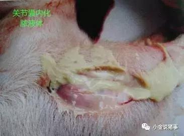 牙龈长脓包怎么治疗,脓疱病怎么治疗最快