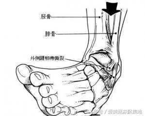没有纤细的脚踝，就不要学杨幂“穿九分裤露脚踝显瘦”