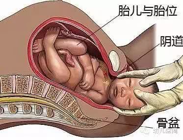 10个顺产9个侧切？关于侧切的这些小常识你必须懂！