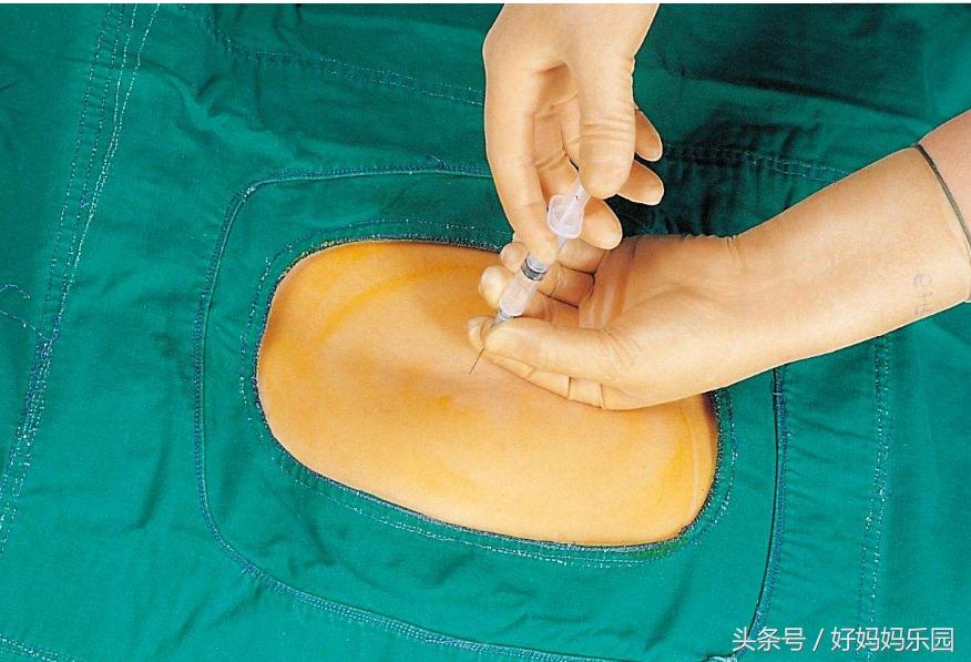 我想推广这项技术，请您支持，因为关系到你身边的她