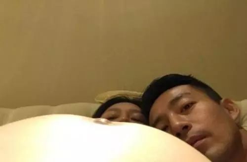 大s癫痫住院真相,大s回应因癫痫住院一事