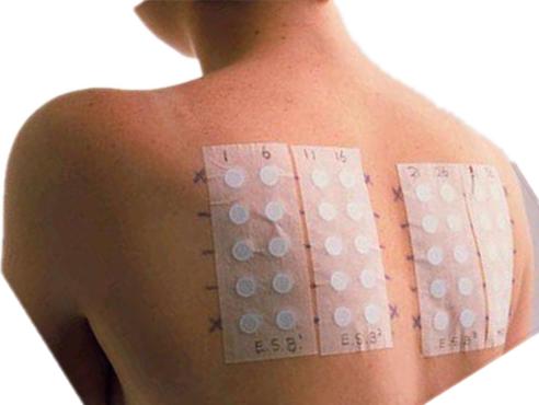 婴儿结膜炎过敏源图片,过敏性结膜炎怎么找过敏原