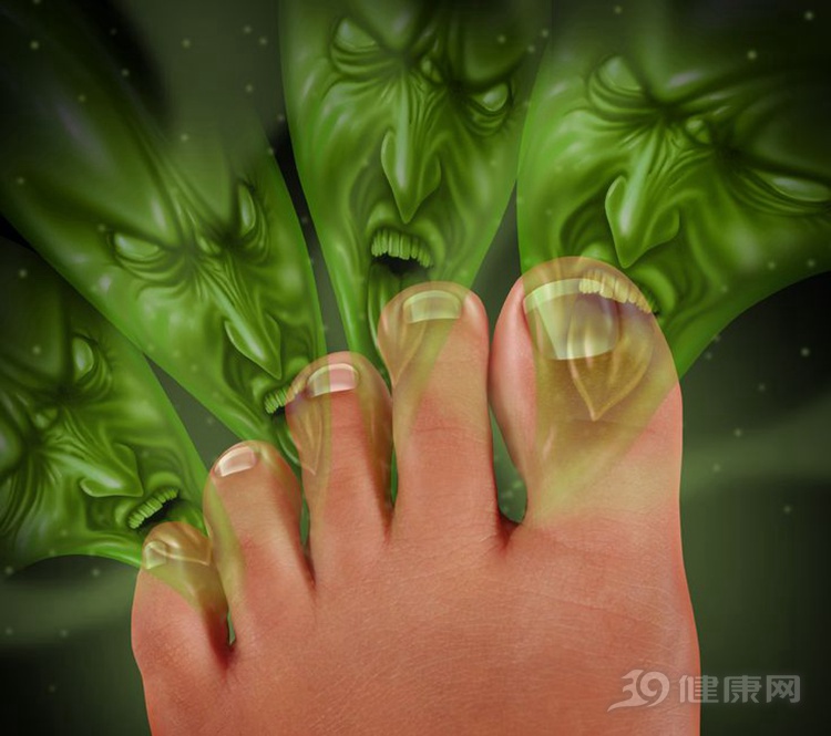 脚臭怎么办教你除臭方法,脚臭真烦人防治脚臭小窍门
