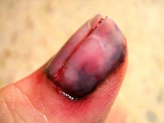 装病请假必备技巧